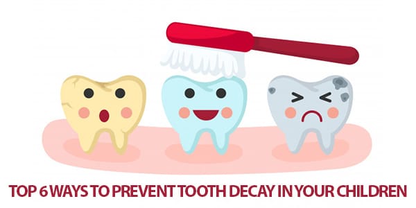 Top 6 Ways To Prevent Tooth Decay In Your Children